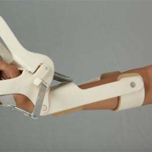 Volkmann Hand Splint